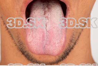 Tongue texture of Lukas 0001